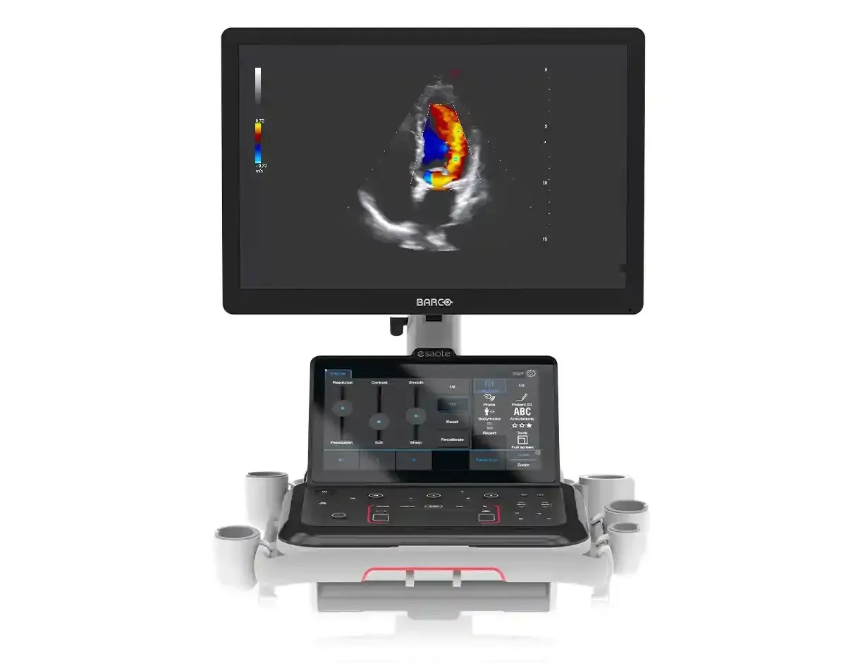 MyLab A70 – Ecografía de alto rendimiento