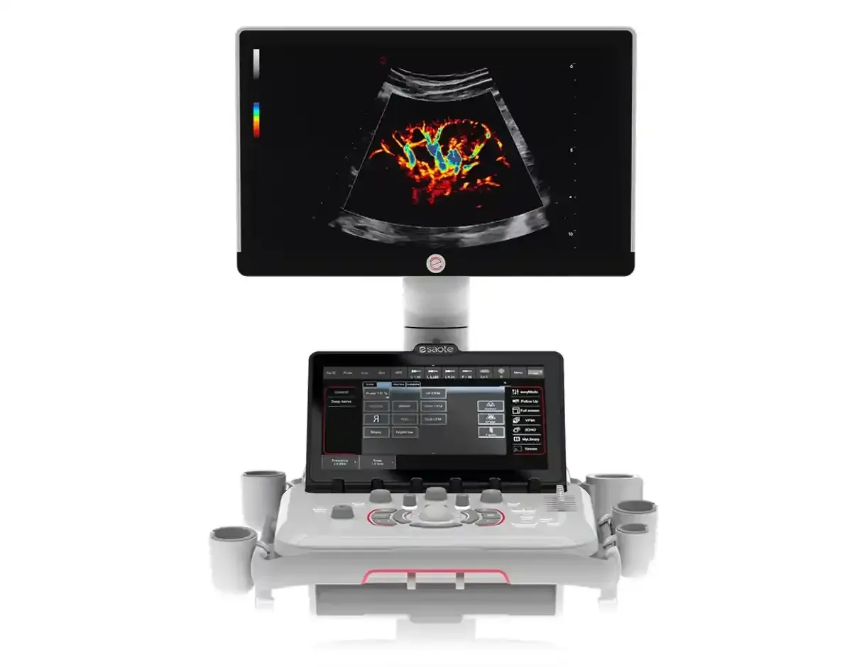 MyLab A50 – Ecografía cardiovascular avanzada